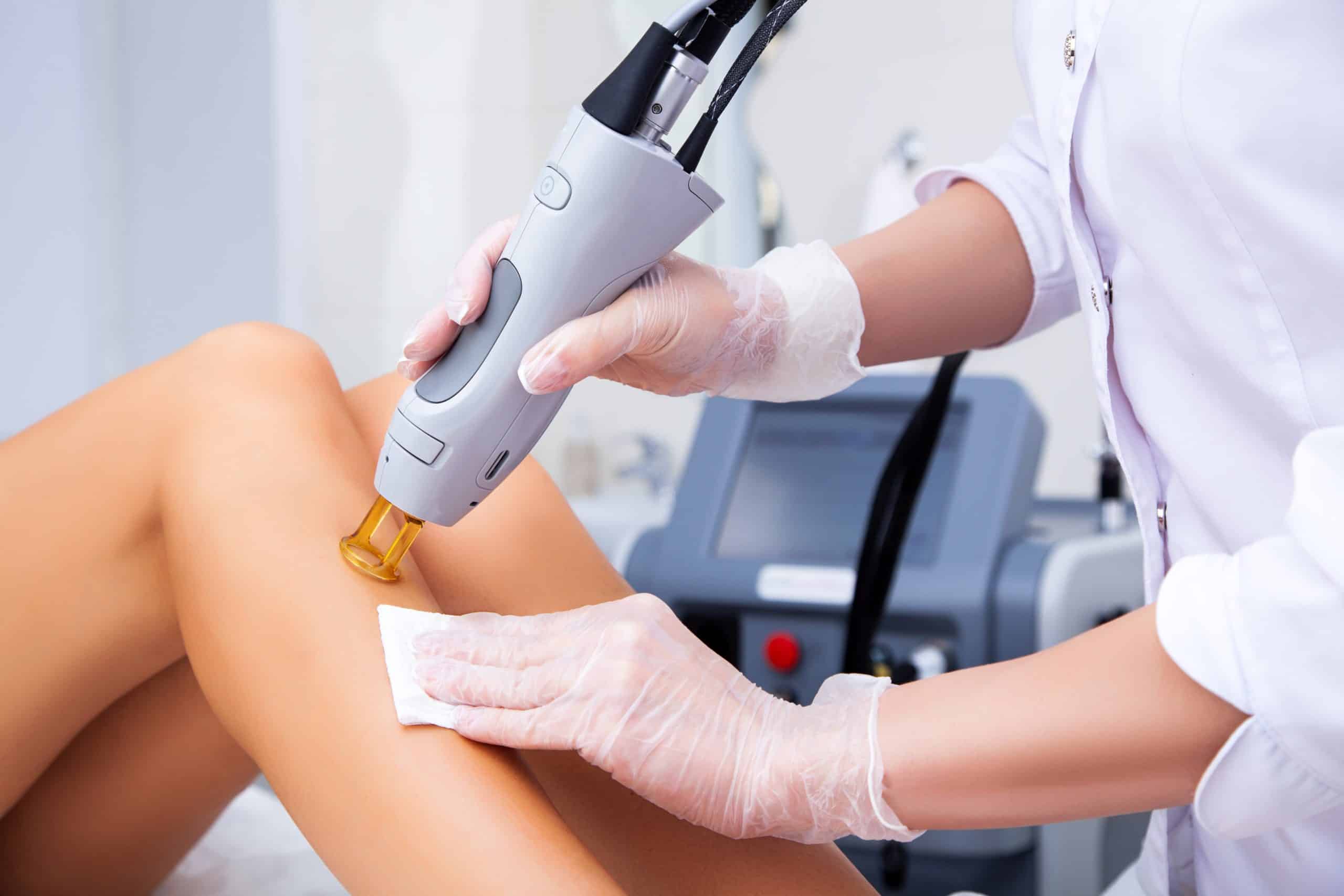 Beautician applying laser hair removal gun on woman leg | Viata Aesthetics and Wellness in Katy TX
