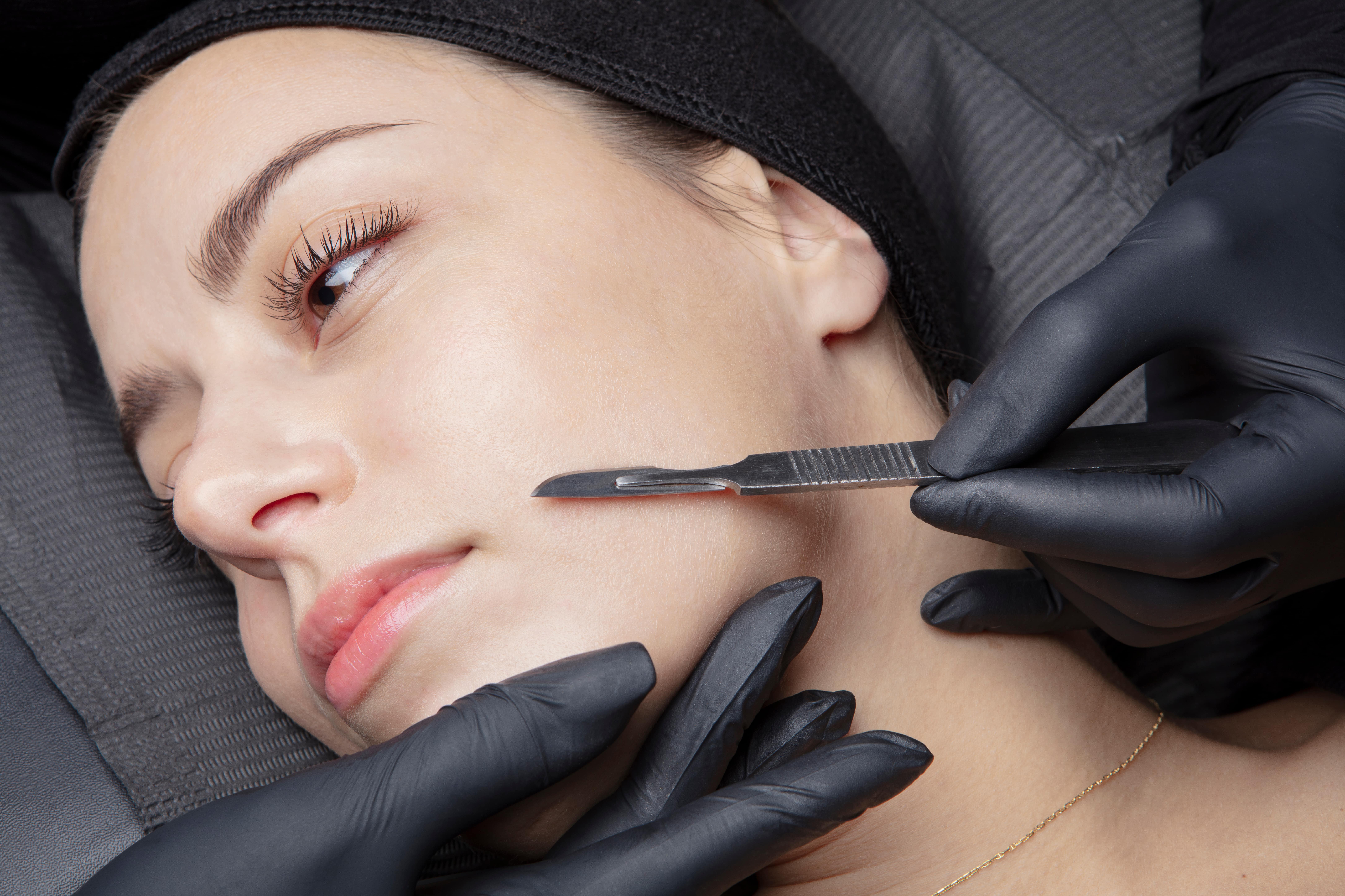 Dermaplaning The Ultimate Guide to Reveal Smooth Glowing Skin